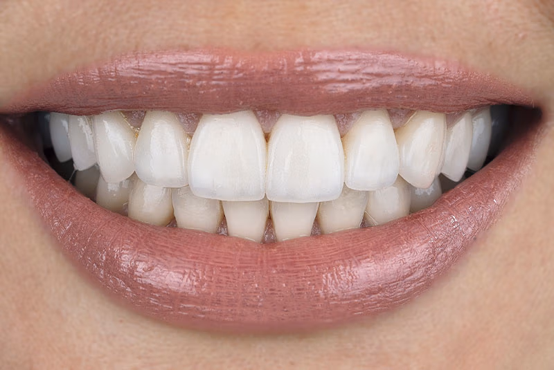 close up of before and after dental procedure