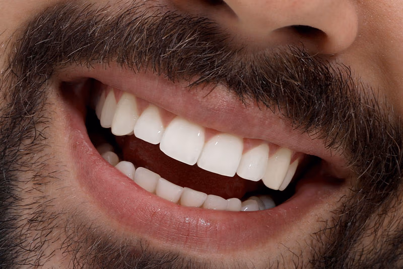 close up of before and after dental procedure