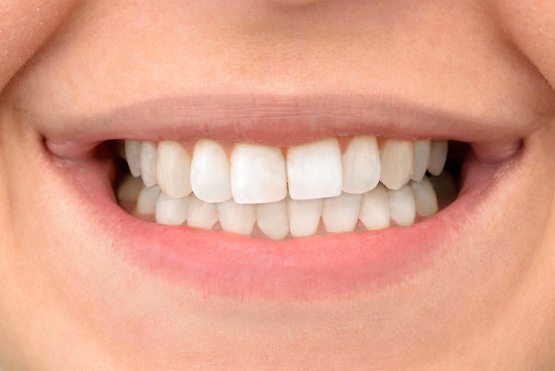 close up of before and after dental procedure